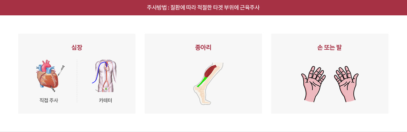 엔젠시스 투여 부위 도식 심장·종아리·손 또는 발 부위별 엔젠시스 근육주사 방법 도식