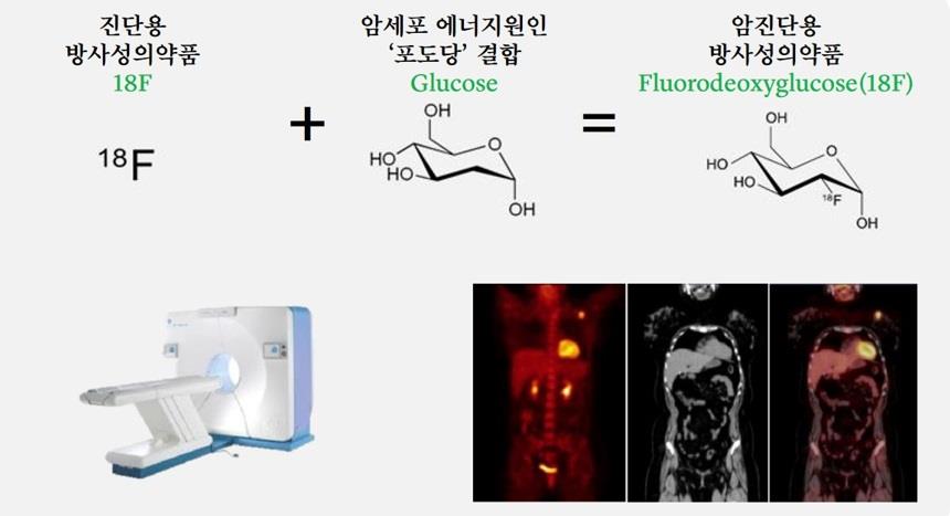 18F-FDG 암 진단용 방사성의약품 작용 원리 18F와 포도당 결합으로 만든 Fluorodeoxyglucose(18F)와 PET 장비·영상 결과를 보여주는 작용 원리