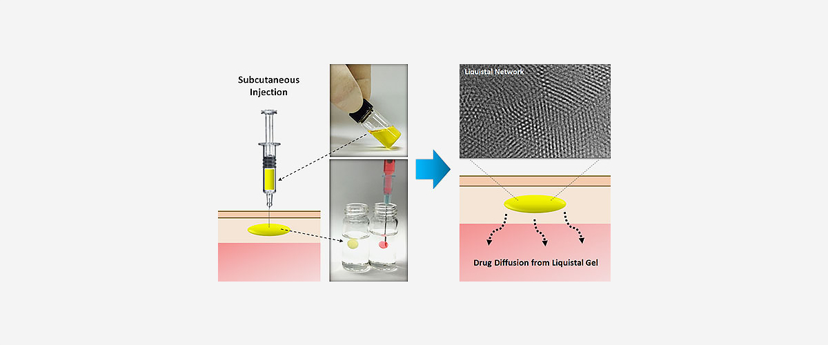 Liquistal 약물전달 기술 개념도 피하주사와 액상 제형의 겔 전환 및 약물 확산을 도식화한 Liquistal 기술 이미지
