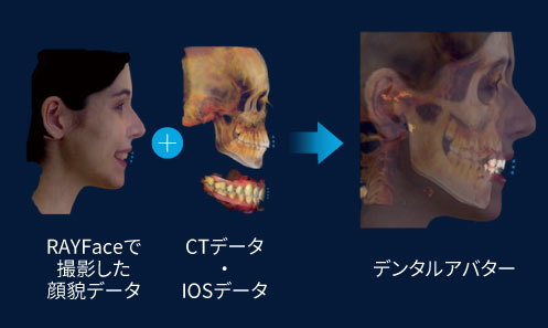 안면 스캔과 CT 데이터를 결합한 덴탈 아바타 구성 안면 사진, 두개골 CT 데이터, 치아가 보이는 디지털 아바타가 화살표로 연결된 도식