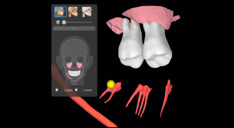 SMARTDent 3D의 치근 구조 시각화 화면 치아와 뿌리 구조의 3D 모델 및 단면 이미지를 표시한 SMARTDent 3D 화면
