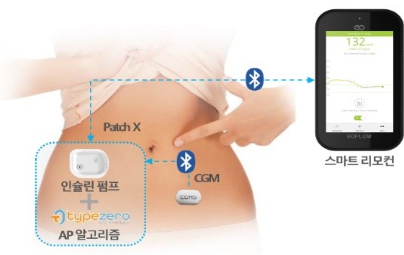 CGM·패치·스마트 리모컨 연계 개념도 복부의 패치형 기기와 CGM, 스마트 리모컨을 블루투스 표시로 연결한 EOPatch X 개념도