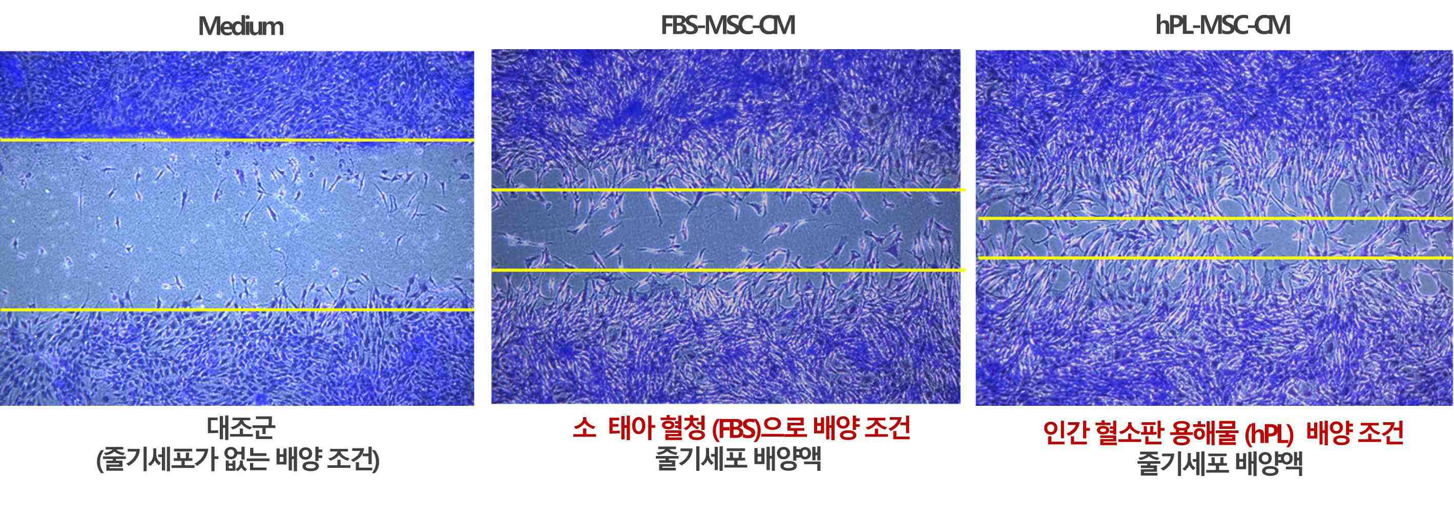 서로 다른 배양 조건의 세포 현미경 비교 대조군, FBS-MSC-CM, hPL-MSC-CM 조건에서 세포가 보이는 현미경 비교 이미지