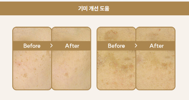 퓨라셀 페이지의 기미 개선 도움 전후 비교 이미지 기미 개선 도움이라는 제목 아래 피부 상태를 Before와 After로 비교한 두 세트의 사진