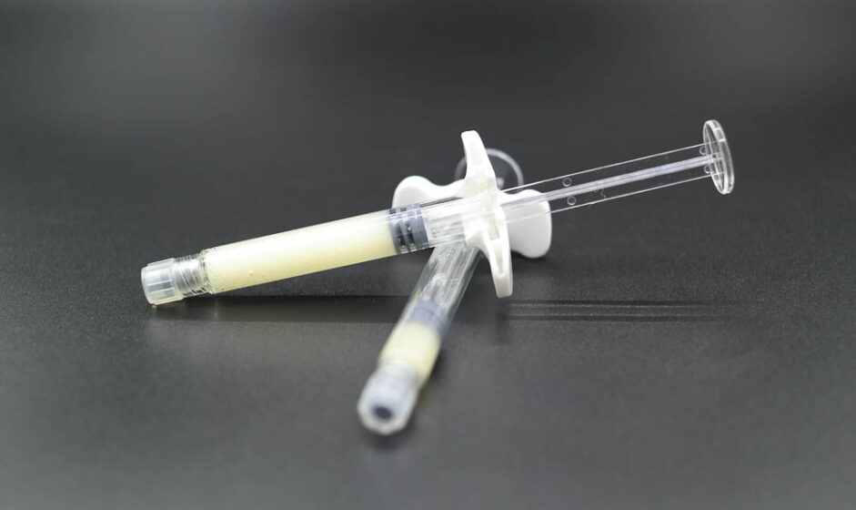 DBM Syringe 생체재료 이식용 뼈 공식 제품 사진